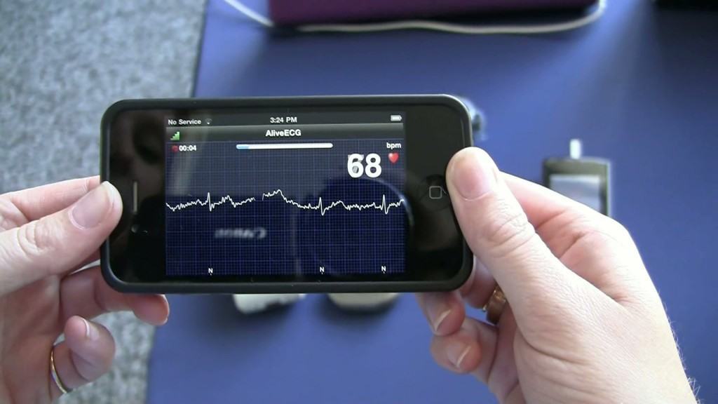 AliveCor biedt een ECG app