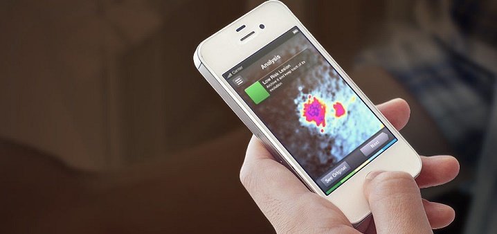 SkinVision app