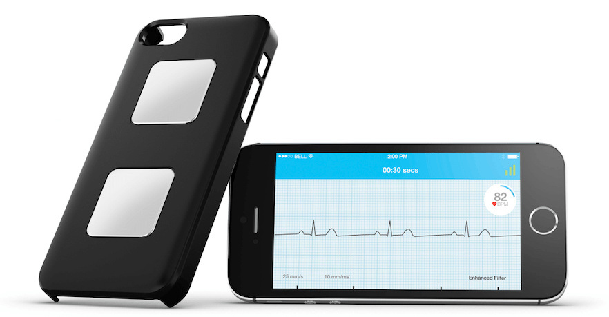 alivecor