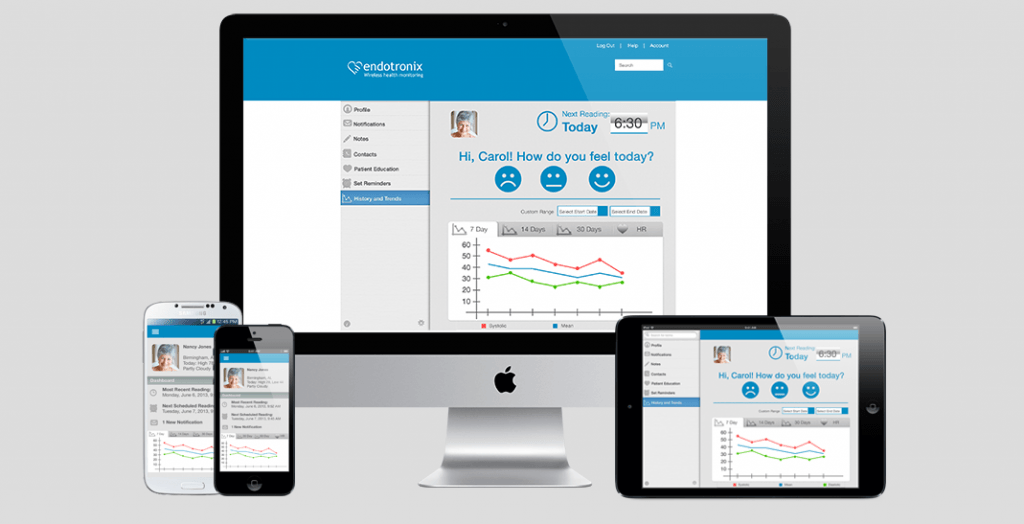 De online omgeving van Endotronix