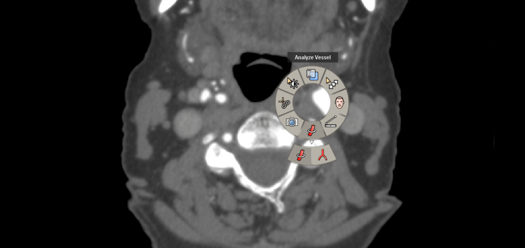 Illumeo Philips scan