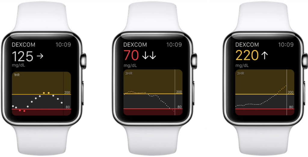 Dexcom apple watch