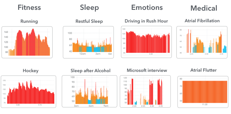 Cardiogram app: machine learning 