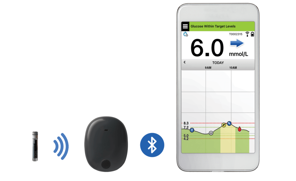 Eversense systeem van Roche