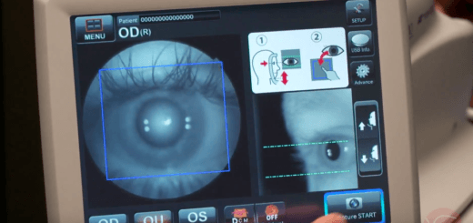 IDx-Dr software kan diabetische retinopathie opsporen met AI