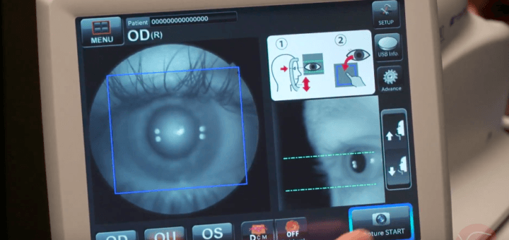 IDx-Dr software kan diabetische retinopathie opsporen met AI