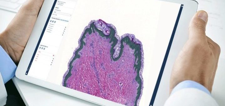 AI_iPad-Pathologie