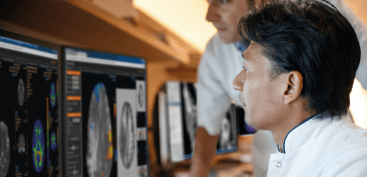 AI voor radiologie