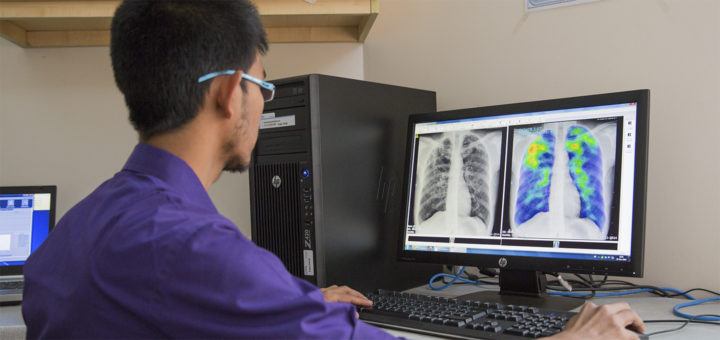 Thirona software AI