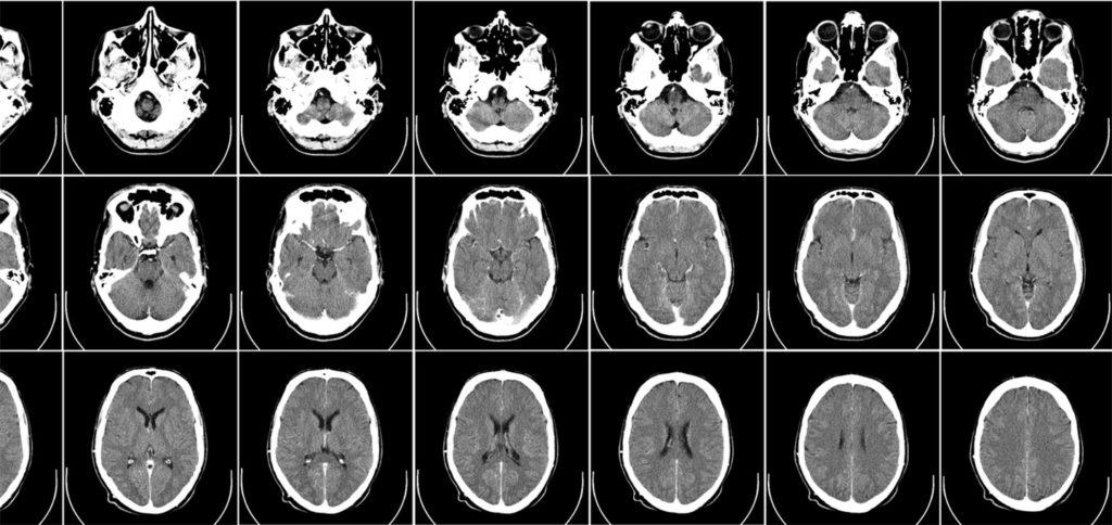 CT-scan (Foto: Uppsala University Hospital - Mikael Häggström)