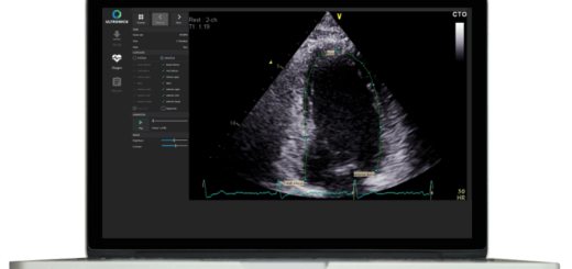 Ultromics ontvangt goedkeuring van FDA voor EchoGo Core, software voor klinische beslissingsondersteuning