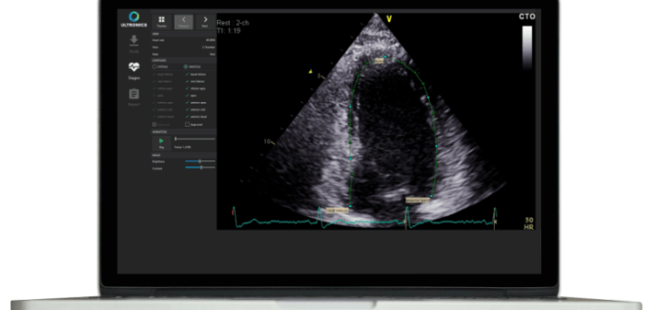 Ultromics ontvangt goedkeuring van FDA voor EchoGo Core, software voor klinische beslissingsondersteuning